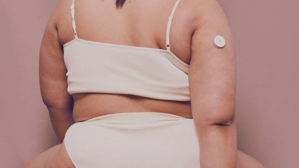 Una foto di una donna bianca seduta di schiena in intimo bianco e un microinfusore insulinico sul braccio